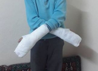 Maraş’ta Okul Müdürü Öğrencinin Parmaklarını Kırdı