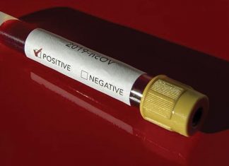 Koronavirüs Tuhaflıkları!