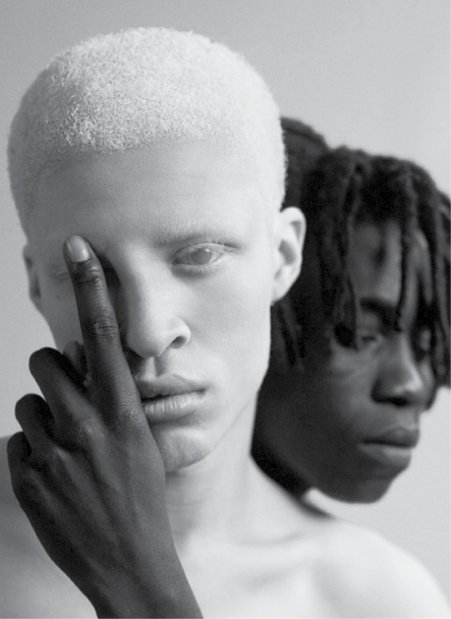 Öteki Beyazlar Albinolar